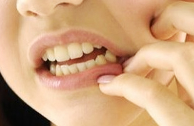 突發(fā)性、自發(fā)性的劇烈牙疼