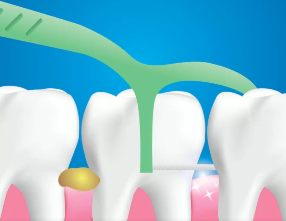 口腔問(wèn)題可能要“命”！5大預(yù)警信號(hào)，別忽視