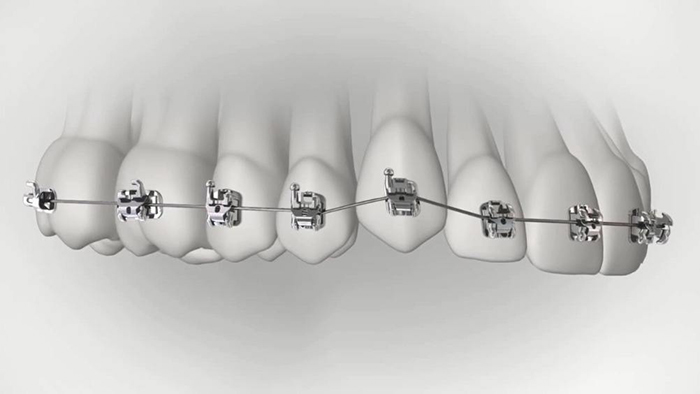 承德市哪家口腔醫(yī)院口腔正畸做得好？惟德口腔醫(yī)院來(lái)告訴您