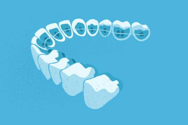 惟德口腔醫(yī)院口腔正畸好不好？